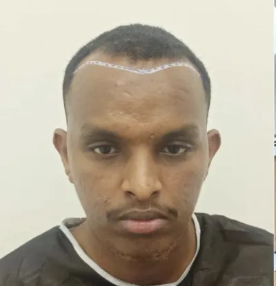 ÖNCE