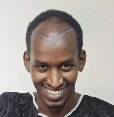 ÖNCE