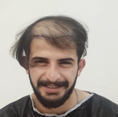 ÖNCE