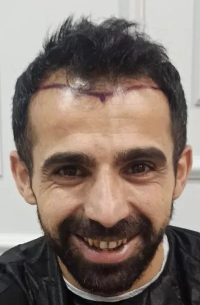 ÖNCE